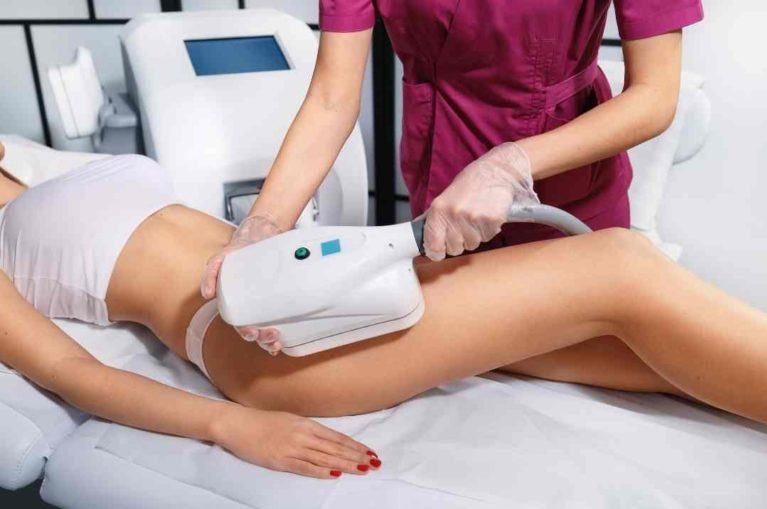 LASER Hair Removal (3)